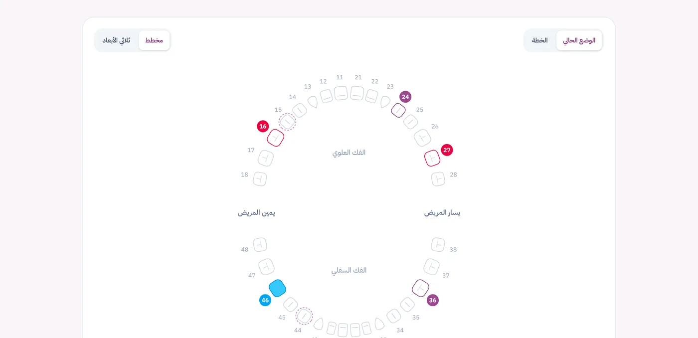 مخطط الأسنان